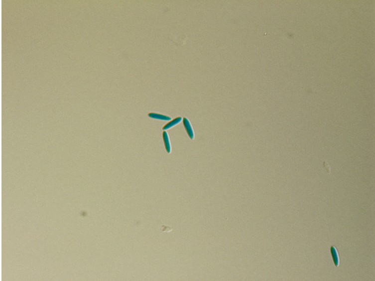 Ophiocordyceps floriformis